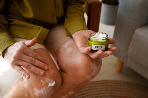 The Benefits of Using Natural Body Lotions for Dry Skin